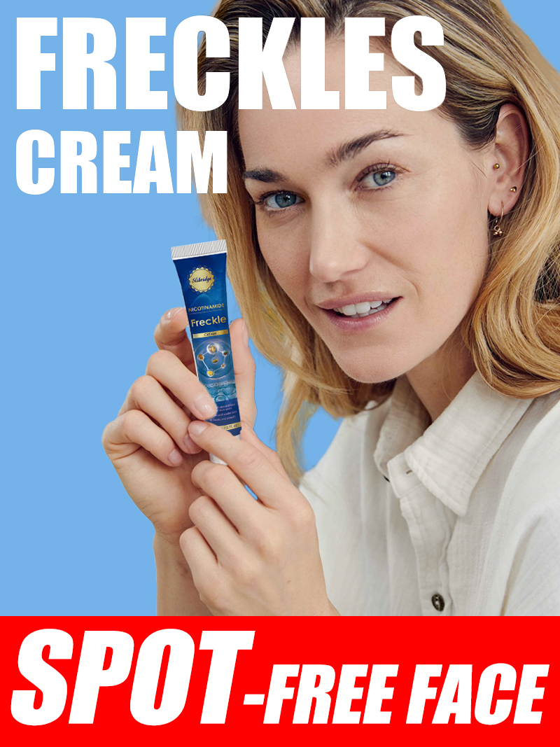 Luxury Skincare Cream - Krim Penghilang Bintik Hitam untuk Wajah,