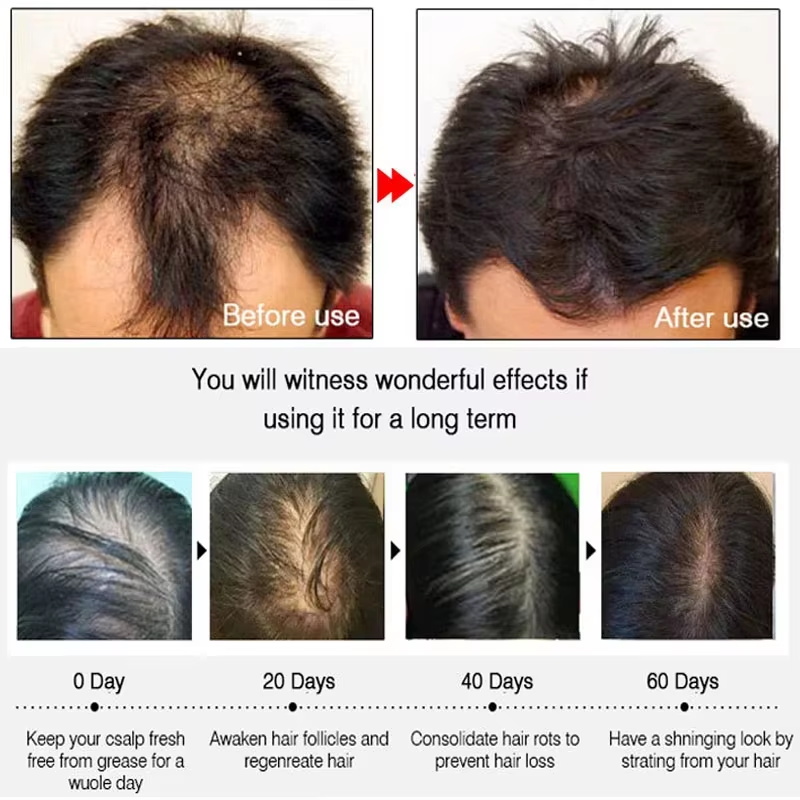 Semprotan Penumbuh Rambut Jahe - Growth Factor Serum ulasan dan harga